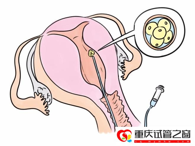 试管婴儿和普通孩子的区别(图1)